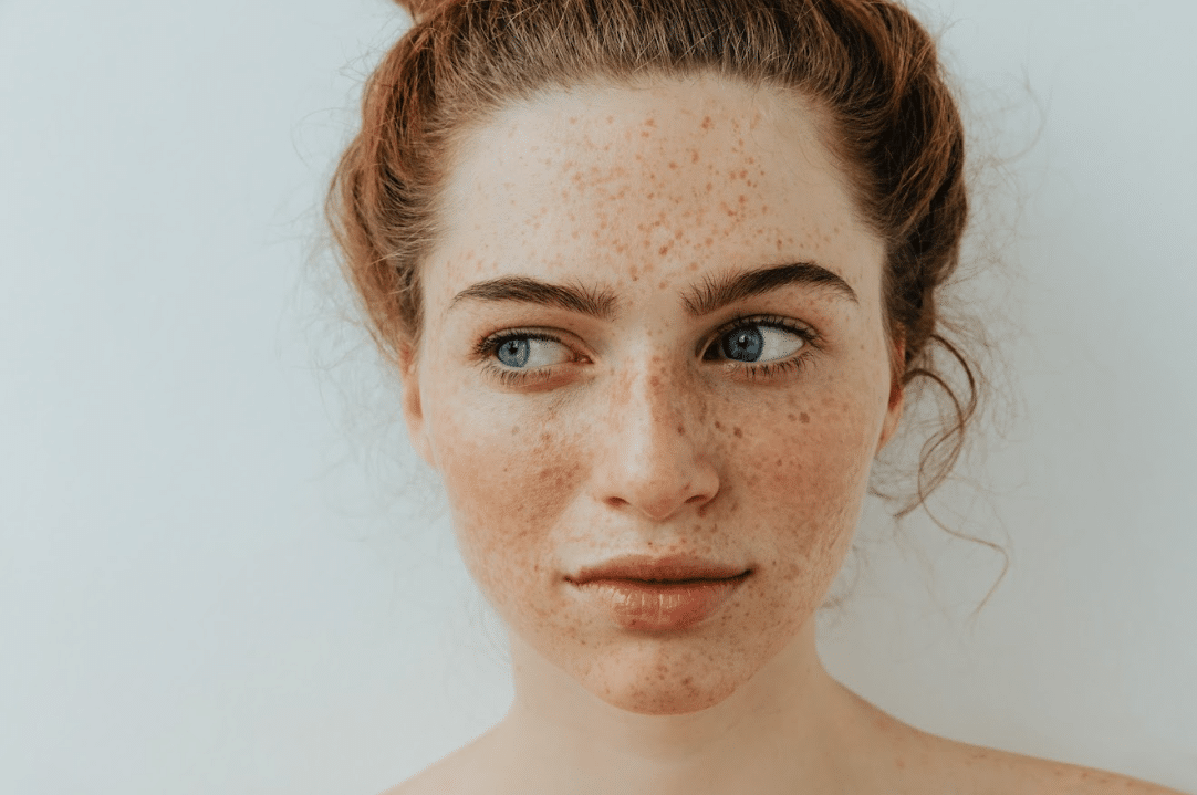 Beautiful young women with freckles