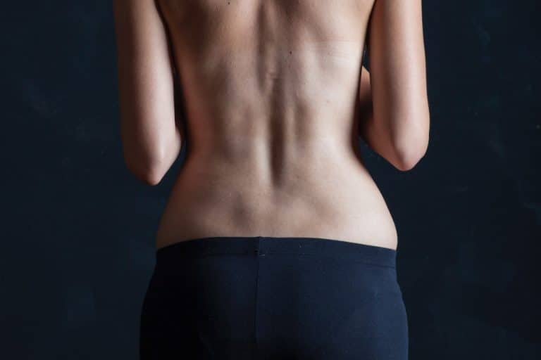 woman's back